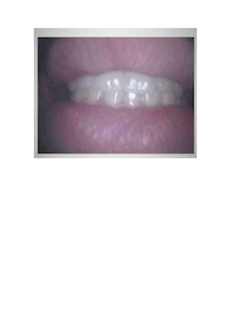 wendigoon's lips by bayleaf-clove